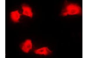 Immunofluorescent analysis of Kanadaptin staining in A431 cells. (NADAP antibody  (Center))