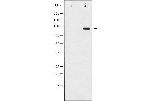 Western blot analysis of Catenin- beta phosphorylation expression in SW626 whole cell lysates,The lane on the left is treated with the antigen-specific peptide.