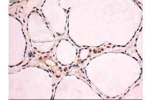 Image no. 8 for anti-Myc Proto-Oncogene protein (MYC) antibody (ABIN1497012) (c-MYC antibody)