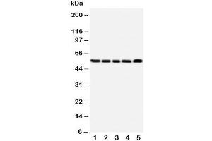 Western blot testing of NK1R antibody and Lane 1:  A549;  2: U87;  3: COLO320;  4: SCG;  5: PANC cell lysate