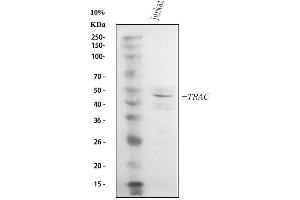 Western blot analysis of TCR alpha/TRAC using anti-TCR alpha/TRAC antibody (ABIN6719654). (TRAC antibody  (AA 1-114))