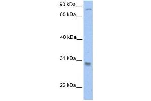 GSTT1 antibody used at 1 ug/ml to detect target protein.