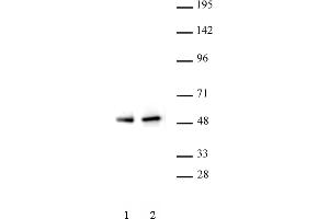 PAX5 antibody (pAb) tested by Western blot. (PAX5 antibody  (N-Term))