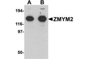 Western blot analysis of ZMYM2 in EL4 cell lysate with ZMYM2 antibody at (A) 0. (ZMYM2 antibody  (N-Term))
