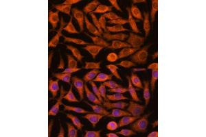 Immunofluorescence analysis of L929 cells using NDUF antibody (ABIN7268807) at dilution of 1:100. (NDUFAF4 antibody  (AA 1-170))
