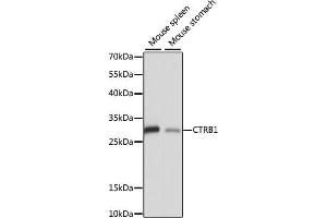Western blot analysis of extracts of various cell lines, using CTRB1 antibody (ABIN7266398) at 1:1000 dilution. (CTRB1 antibody  (AA 79-263))