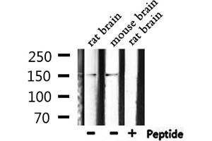 Western blot analysis of extracts from rat brain, mouse brain, using Phospho-PLCG1 (Tyr771) Antibody. (Phospholipase C gamma 1 antibody  (pTyr771))