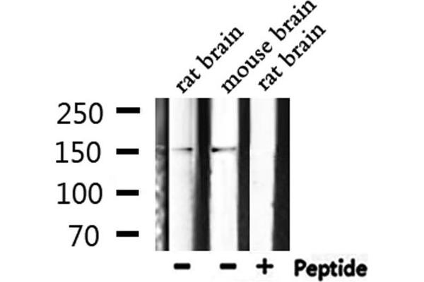 Phospholipase C gamma 1 antibody  (pTyr771)