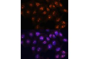 Immunofluorescence analysis of HeLa cells using Fibrillarin/U3 RNP antibody (ABIN6130429, ABIN6140494, ABIN6140496 and ABIN6217509) at dilution of 1:100. (Fibrillarin antibody  (AA 100-321))