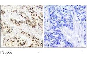 Image no. 1 for anti-Cyclin-Dependent Kinase 1 (CDK1) (Tyr15) antibody (ABIN197482) (CDK1 antibody  (Tyr15))