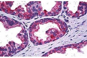 Human Prostate: Formalin-Fixed, Paraffin-Embedded (FFPE) (MAPK13 antibody  (AA 251-365))