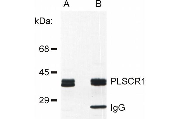 PLSCR1 anticorps