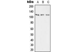 Western blot analysis of PMCA2 expression in HEK293T (A), mouse brain (B), rat brain (C) whole cell lysates. (ATP2B2 antibody  (Center))