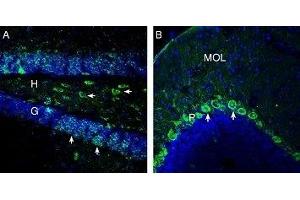 Expression of OXGR1/GPR99 in mouse hippocampus and cerebellum - Immunohistochemical staining of perfusion-fixed frozen mouse brain sections with Anti-OXGR1/GPR99 Antibody (ABIN7043418, ABIN7044895 and ABIN7044896), (1: 200), followed by goat anti-rabbit-AlexaFluor-488. (OXGR1 antibody  (C-Term, Intracellular))
