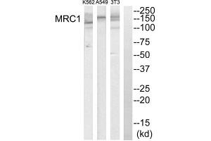 Western blot analysis of extracts from K562 cells, A549 cells and NIH-3T3 cells, using MRC1 antibody. (Macrophage Mannose Receptor 1 antibody  (Internal Region))