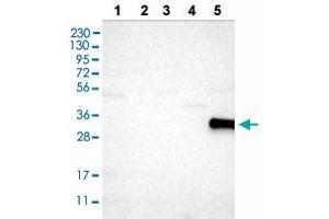 Western blot analysis of Lane 1: RT-4 cells, Lane 2: U-251MG sp cells, Lane 3: Human plasma (IgG/HSA depleted), Lane 4: Human liver tissue, Lane 5: Human tonsil tissue with CD226 polyclonal antibody . (CD226 antibody  (AA 102-251))