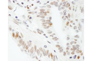 Immunohistochemistry (IHC) image for anti-Transcription Elongation Factor SPT5 (SUPT5H) (C-Term) antibody (ABIN7454524)