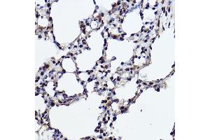 Immunohistochemistry of paraffin-embedded rat lung using R Rabbit mAb (ABIN7269844) at dilution of 1:100 (40x lens). (RanBP3 antibody)