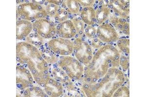 Immunohistochemistry of paraffin-embedded Mouse kidney using NLRC4 Polyclonal Antibody at dilution of 1:100 (40x lens). (NLRC4 antibody)