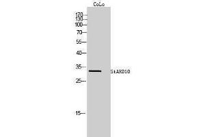 Western Blotting (WB) image for anti-StAR-Related Lipid Transfer (START) Domain Containing 10 (STARD10) (Internal Region) antibody (ABIN3187075) (STARD10 antibody  (Internal Region))