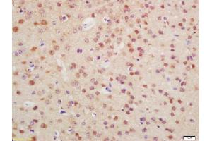 Formalin-fixed and paraffin embedded mouse brain labeled with Anti-OTX1 + OTX2 Polyclonal Antibody, Unconjugated (ABIN1387702) at 1:200 followed by conjugation to the secondary antibody and DAB staining (Otx1 + Otx2 (AA 21-120) antibody)