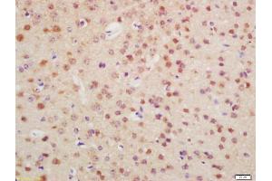 Formalin-fixed and paraffin embedded mouse brain labeled with Anti-OTX1 + OTX2 Polyclonal Antibody, Unconjugated (ABIN1387702) at 1:200 followed by conjugation to the secondary antibody and DAB staining (Otx1 + Otx2 (AA 21-120) antibody)