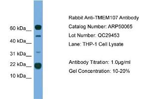 WB Suggested Anti-TMEM107  Antibody Titration: 0. (TMEM107 antibody  (N-Term))