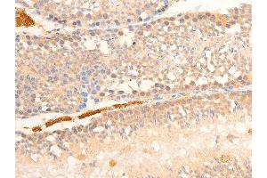 ABIN6267070 at 1/100 staining mouse testis tissue sections by IHC-P.