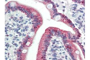 Human Small Intestine (formalin-fixed, paraffin-embedded) stained with LASS5at 5 µg/ml followed by biotinylated goat anti-rabbit IgG secondary antibody, alkaline phosphatase-streptavidin and chromogen. (LASS5 antibody  (C-Term))