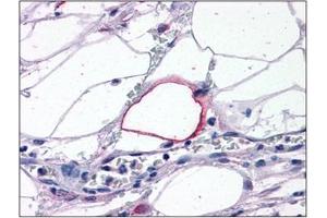 Human Adipocytes: Formalin-Fixed, Paraffin-Embedded (FFPE) (TRIM7 antibody  (C-Term))