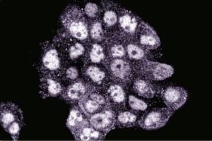 Immunofluorescence staining of A431 cells (Human epithelial carcinoma, ATCC CRL-1555). (BID antibody  (AA 50-62))