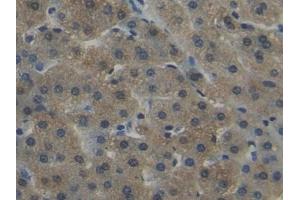 Immunohistochemistry (IHC) image for anti-Nicotinamide N-Methyltransferase (NNMT) (AA 1-258) antibody (ABIN7436480)