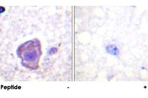 Immunohistochemical analysis of paraffin-embedded human brain tissue using PTK2 polyclonal antibody . (FAK antibody)