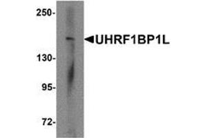 Western blot analysis of UHRF1BP1L in mouse brain tissue lysate with UHRF1BP1L antibody at 1 ug/mL (UHRF1BP1L antibody  (Middle Region))