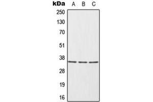 Western blot analysis of HUR expression in HeLa (A), Ramos (B), Jurkat (C) whole cell lysates. (ELAVL1 antibody  (Center))