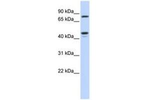 Image no. 1 for anti-Carbohydrate (N-Acetylglucosamine 6-O) Sulfotransferase 6 (CHST6) (AA 288-337) antibody (ABIN6743497) (CHST6 antibody  (AA 288-337))