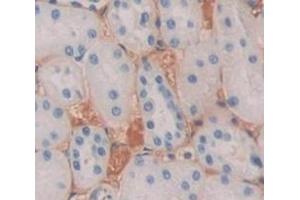 #VALUE! (SEMA4D/CD100 antibody  (AA 145-494))