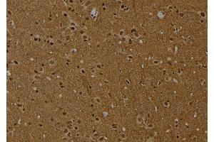 ABIN6274016 at 1/100 staining Rat brain tissue by IHC-P. (Histone H2A antibody  (acLys9))