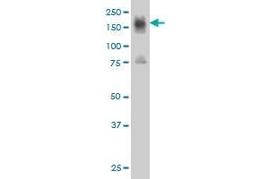 ITGA4 monoclonal antibody (M01), clone 2C11 Western Blot analysis of ITGA4 expression in Jurkat . (ITGA4 antibody  (AA 98-207))