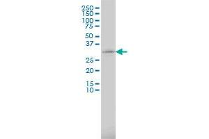 RPS6 monoclonal antibody (M01), clone 3H1-F2. (RPS6 antibody  (AA 1-249))