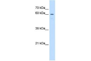 WB Suggested Anti-UNCX Antibody Titration:  1 ug/ml  Positive Control:  Jurkat cell lysate (UNCX antibody  (C-Term))