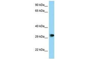 Image no. 1 for anti-PHD Finger Protein 23 (PHF23) (AA 191-240) antibody (ABIN6748146) (PHF23 antibody  (AA 191-240))