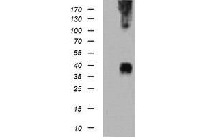Image no. 1 for anti-Mitogen-Activated Protein Kinase Kinase 3 (MAP2K3) antibody (ABIN1499412) (MAP2K3 antibody)