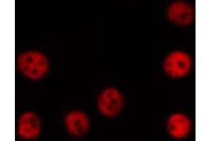 ABIN6266699 staining COLO205 by IF/ICC. (TRIM24 antibody  (C-Term))