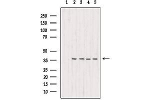 Western blot analysis of extracts from various samples, using MDH1 Antibody. (MDH1 antibody  (C-Term))