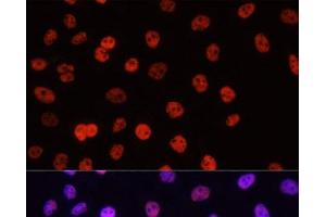 Immunofluorescence analysis of HeLa cells using Asymmetric DiMethyl-Histone H3-R17 Polyclonal Antibody at dilution of 1:100. (Histone 3 antibody  (H3R17me2a))