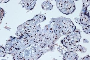 Immunohistochemistry of paraffin-embedded human placenta using PROX1 Rabbit mAb (ABIN7269571) at dilution of 1:100 (40x lens). (PROX1 antibody)