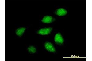 Immunofluorescence of purified MaxPab antibody to ARFIP2 on HeLa cell.