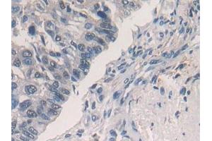 Immunohistochemistry (IHC) image for anti-Phospholamban (PLN) (AA 1-52) antibody (ABIN7442687)