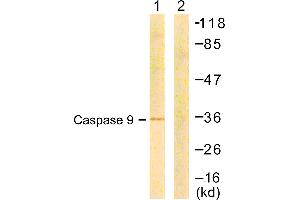 Western blot analysis of extracts from COS7 cells, treated with Etoposide (25uM, 24hours), using Caspase 9 (Ab-144) antibody. (Caspase 9 antibody  (Ser144))